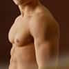 Gynecomastia - Get The Answers To Your Questions!